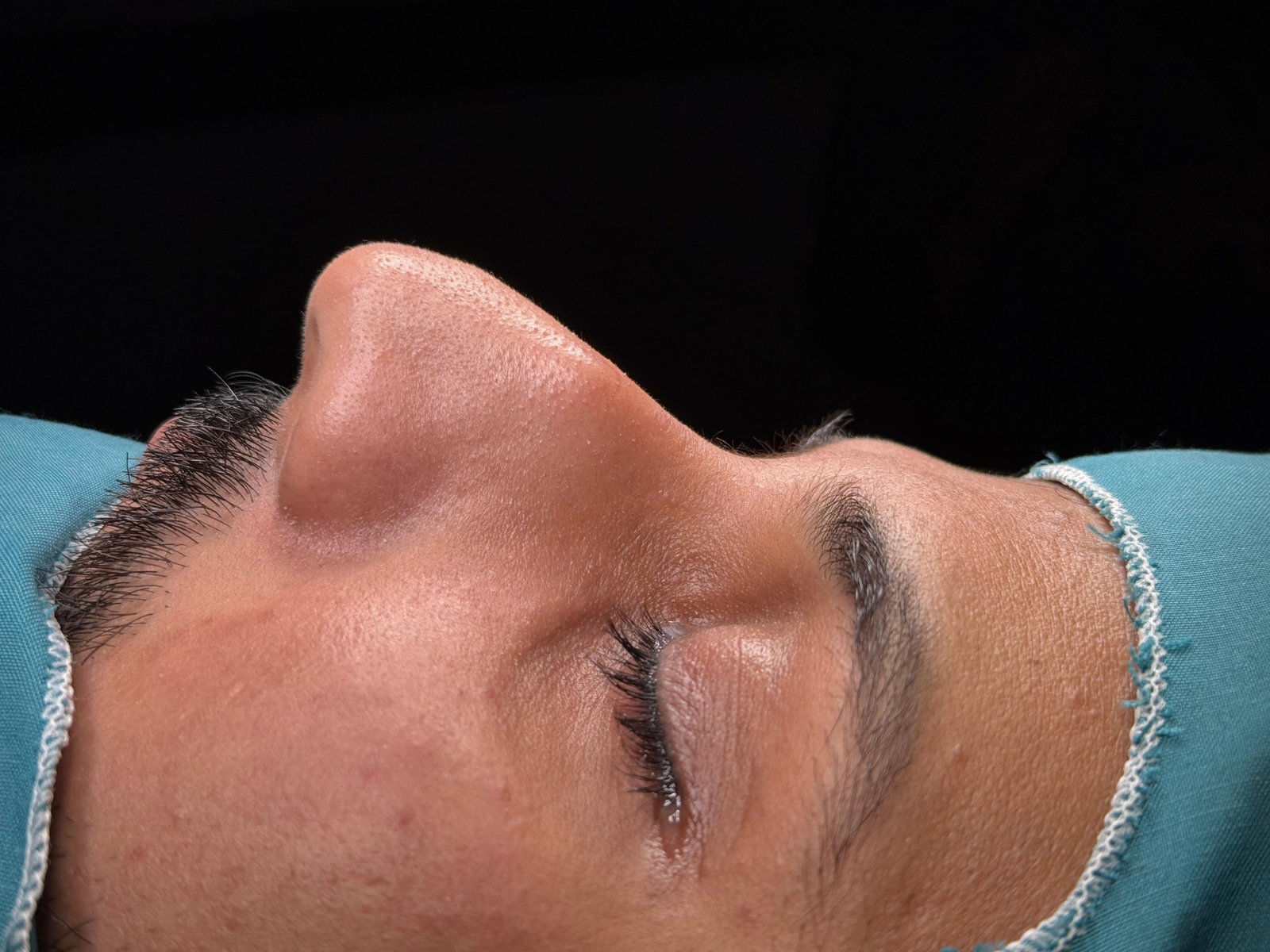 surgery at dr hijrats Clinic