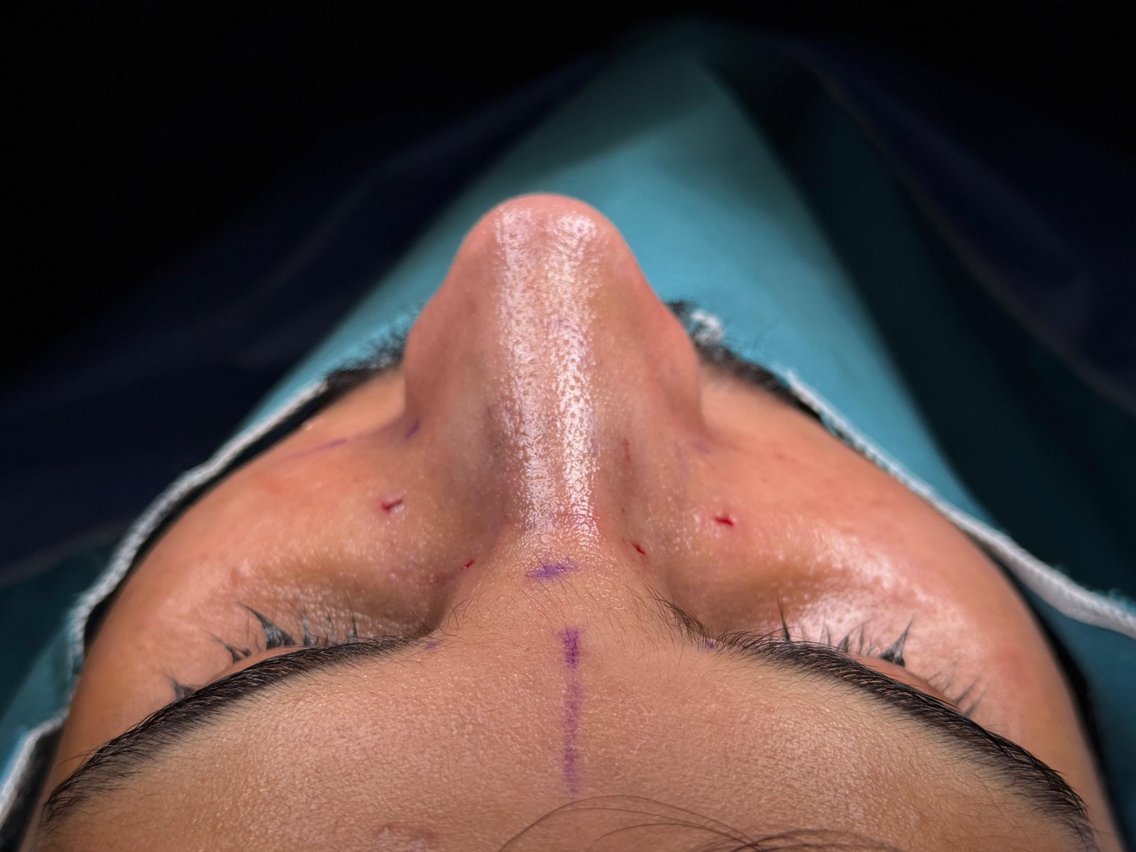 surgery at dr hijrats Clinic