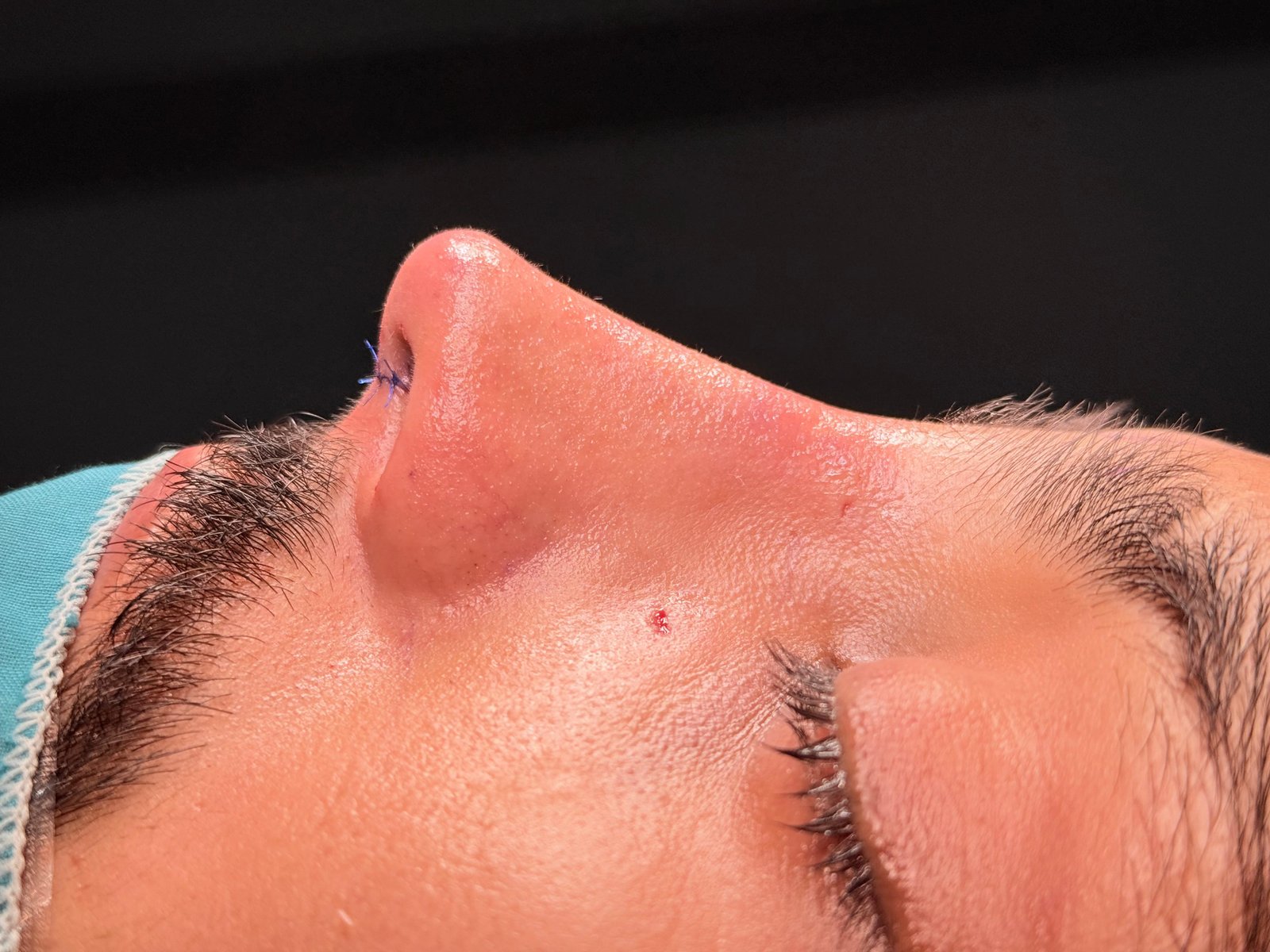 surgery at dr hijrats Clinic