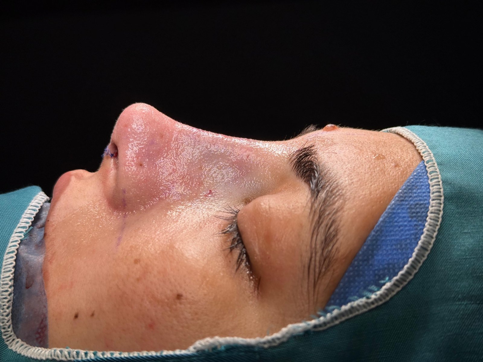 surgery at dr hijrats Clinic