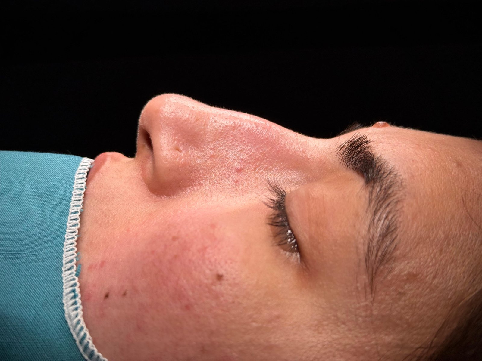 surgery at dr hijrats Clinic